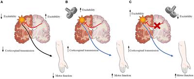 Evaluation of fMRI activation in post-stroke patients with movement disorders after repetitive transcranial magnetic stimulation: a scoping review